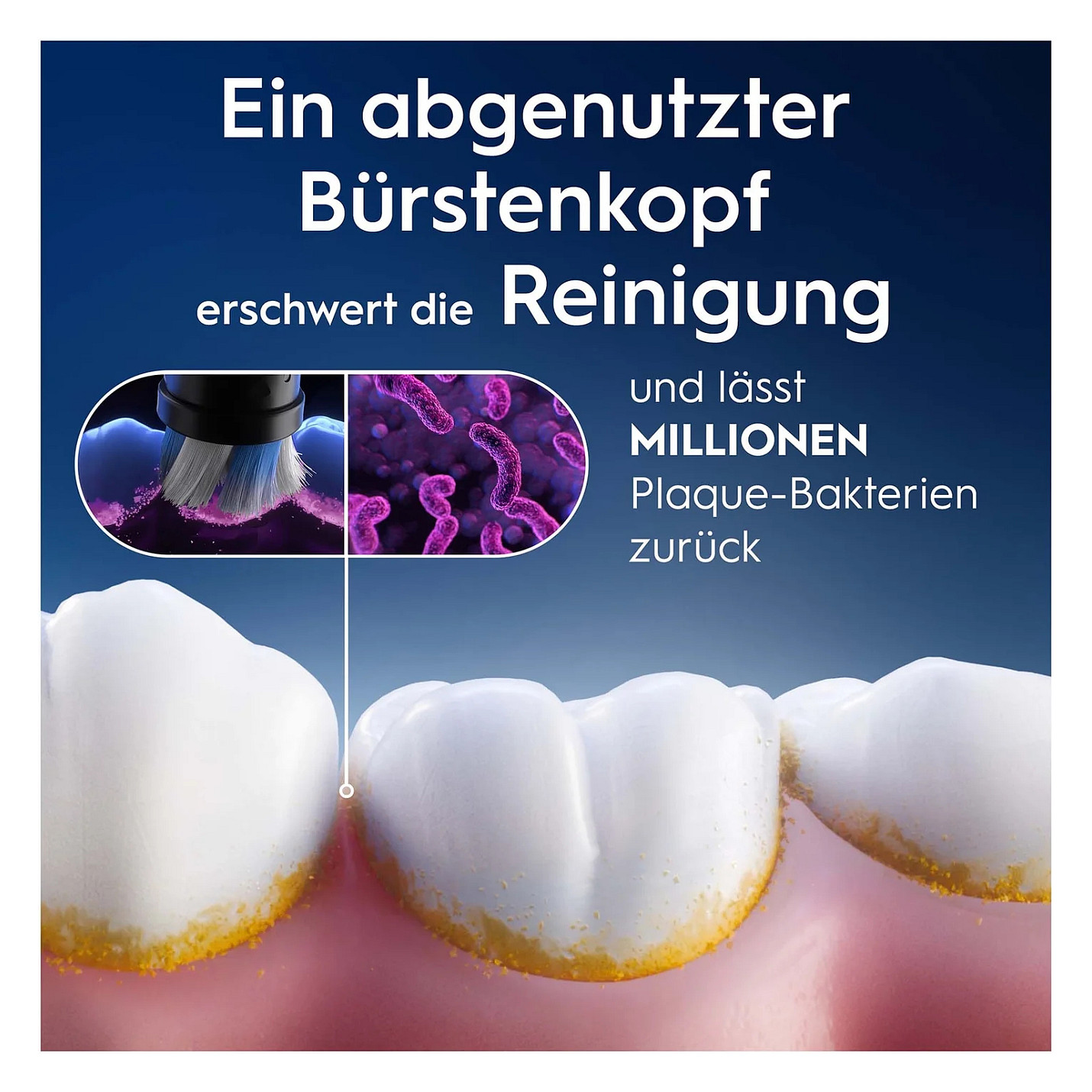 Koka zëvendësuese Oral-B iO Gentle Care, 4 copë - Zezë 5